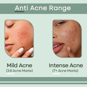 Anti Acne Face Serum / 30 ml For All Skin Type