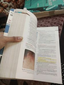 Essentials of Medical Microbiology