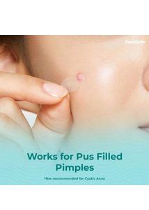 Pimple 👃 Patches 🙀