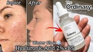 The Ordinary Face Serum