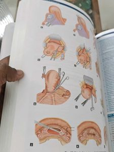 DC Dutta Gynecology Textbook