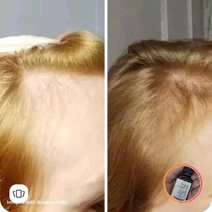 Minimalist Hair Growth Serum