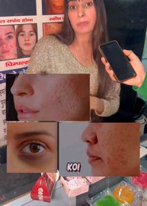 Koriyan Glass Skin Challenge In 15 Days 💯 Persent