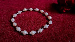 Stunning Anklet 🍒🪄