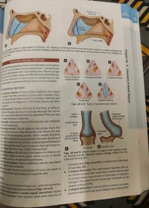 Disease Of Ear Nose And Throat Mohan Bansal (Ent)