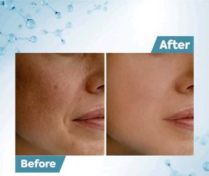 Raaga Professional De-Tan Cream