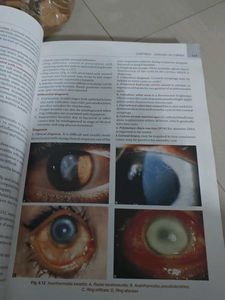 Comprehensive Ophthalmology 7th Edition