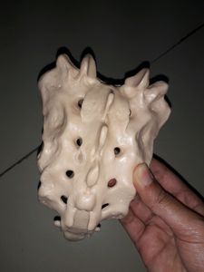 Bone Set-3 (Vertebras + Sacrum) For Medicals!!✏