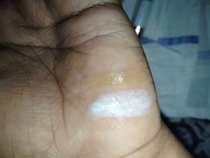 A Beautiful Contact Concealer From Korean Brand
