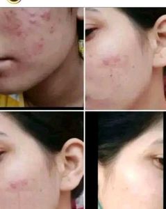 Day &amp; Night Cream Combo