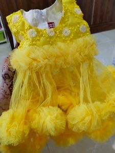 Yellow Baby Frock
