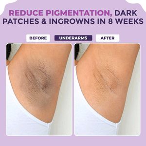 [ONLY 1] Sanfe Sensitive Areas Lightening Serum