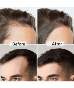 ORGATRE HAIR OIL FOR GROWTH AND REGROWTH