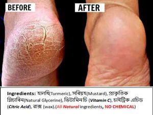 Crack Repair Cream -True 100% guarantee