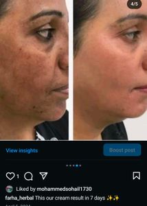 Skin Problem Solution
