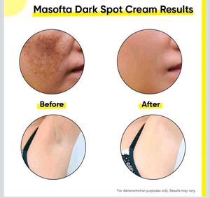 Masofta Dark Spot Cream (bargaining Allowed)