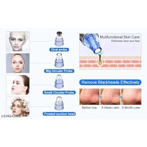 Blackheads And Whiteheads Cleaner