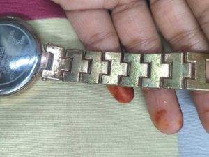 Fossil Watch
