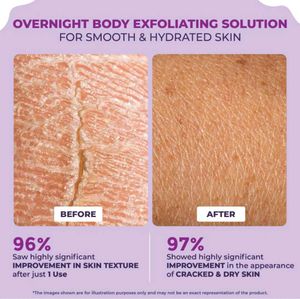 (Pack of 2) Sanfe Body Creams for Dry&amp;Cracked Feet