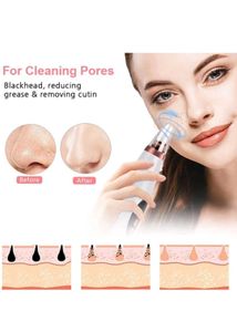 Blackhead Remover Device