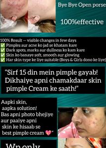 Effective Pimple Cream - 20 Days!