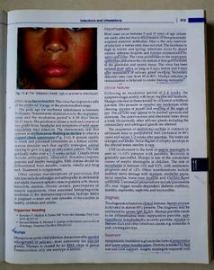 Ghai Essential Pediatrics, 9th Edition