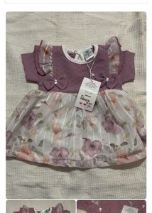 Baby Dresses Combo