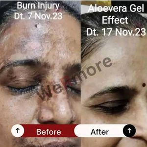 Aloe Vera Gel - WeRmore Solutions