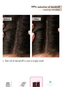 Mcaffeine Naked &amp; Raw Coffee Scalp Scrub