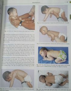 GHAI ESSENTIAL PEDIATRICS NINTH EDITION