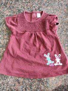 Combo Of 11 Cute Plaid Baby Dress