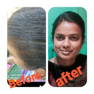 Assure Hair Oil And Shampo
