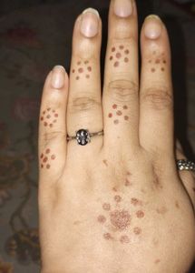 Antique Look Rings From Forever 21