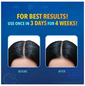 Scalpe Plus Ketoconazole 2% Anti Dandruff Shampoo