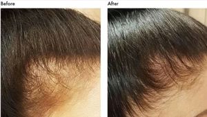 Adivasi Neelgiri Herbal Hair Oil