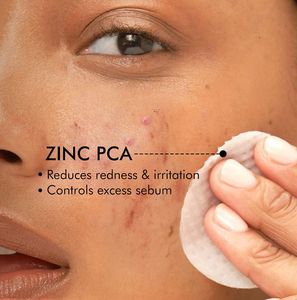 Anti Acne Pads