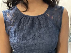 Best Casual Wear Frock