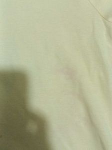 Yellow Adidas Tshirt