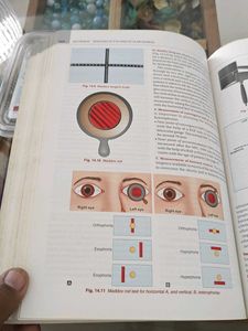 Comprehensive Ophthalmology