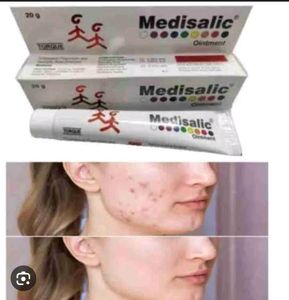 Medisalic Cream Used for Skin Brightening