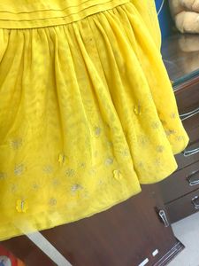 Yellow 🟡 Frock 💛