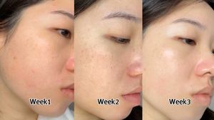 The Derma Co. Kojic Acid Face Serum