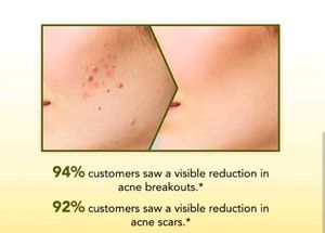 Acne Face Wash With Salicylic Acid