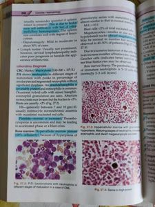 Concise Haematology Textbook