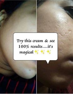 Fairness Cream 100% Results Money Back Gurantee If