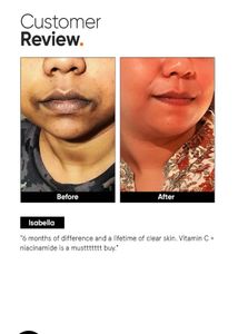 Minimalist Vitamin C Face Serum