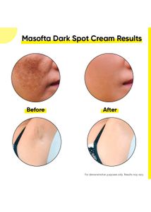 Masofta Dark Spot Reduction &amp; Removal Cream