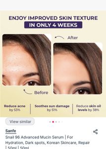 Snail 🐌 Face Serum ( All Skin Types)