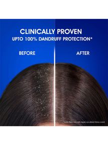 Head &amp; Shoulders Anti Dandruff Shampoo