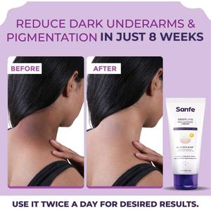 Sanfe Spotlite Body Lightening Cream